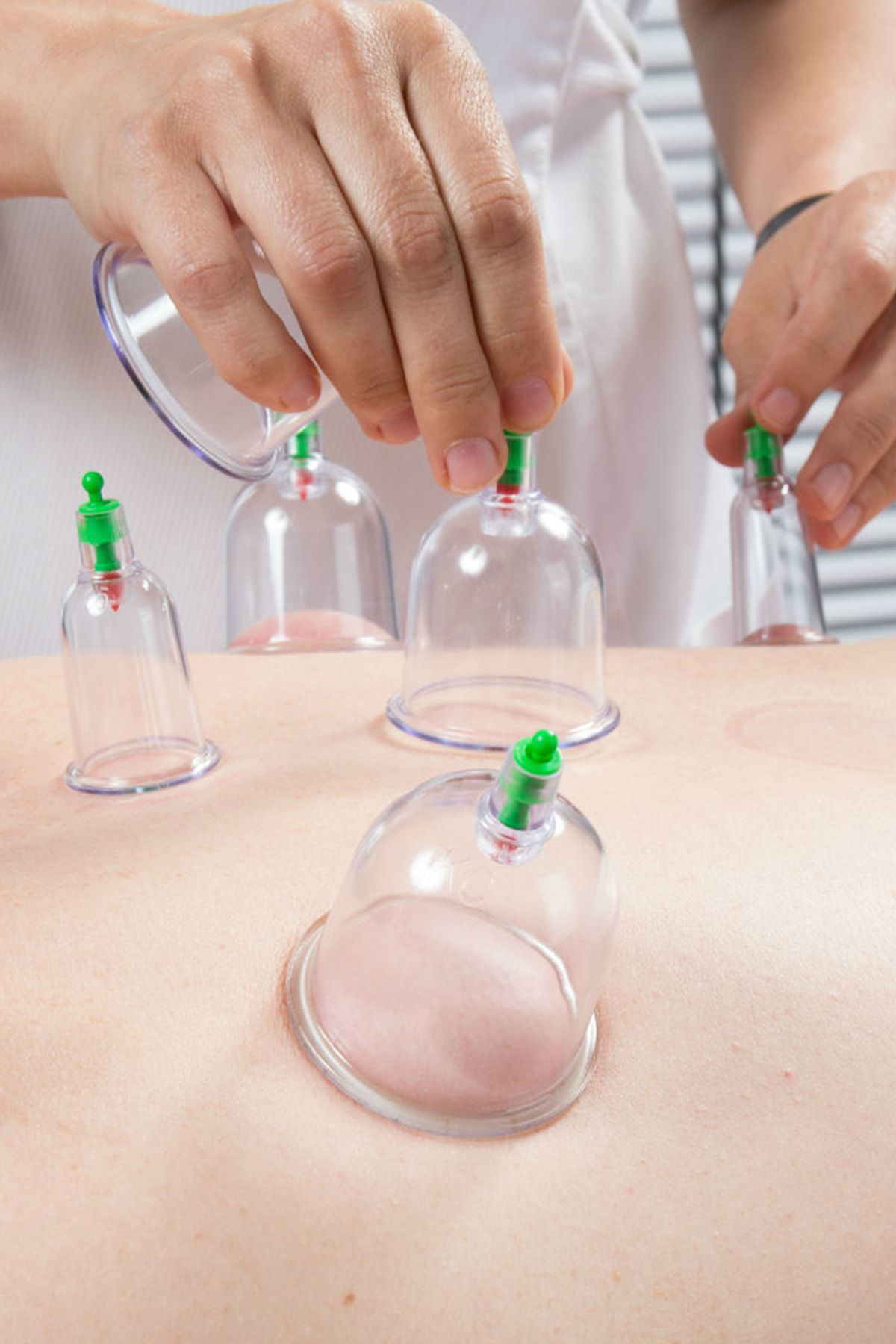 Technostation Vakumlu Bardak Kupa Çekme Seti Hacemat 12 Li