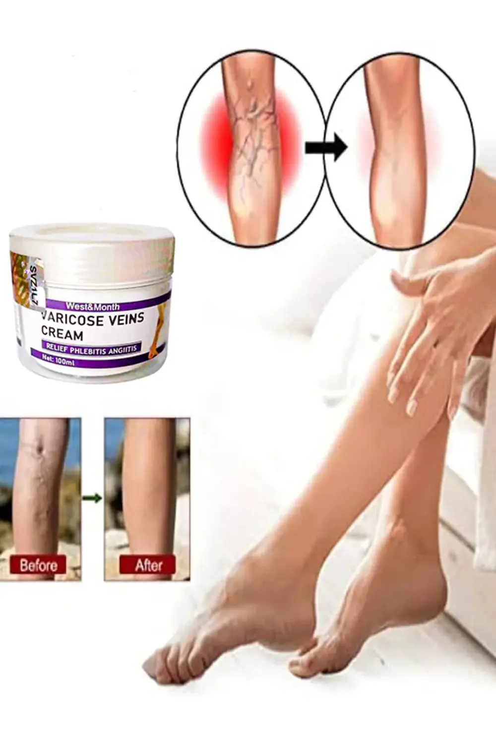 Varicose and Spider Veins Soothing Leg Cream Bacak Bakım Kremi 10