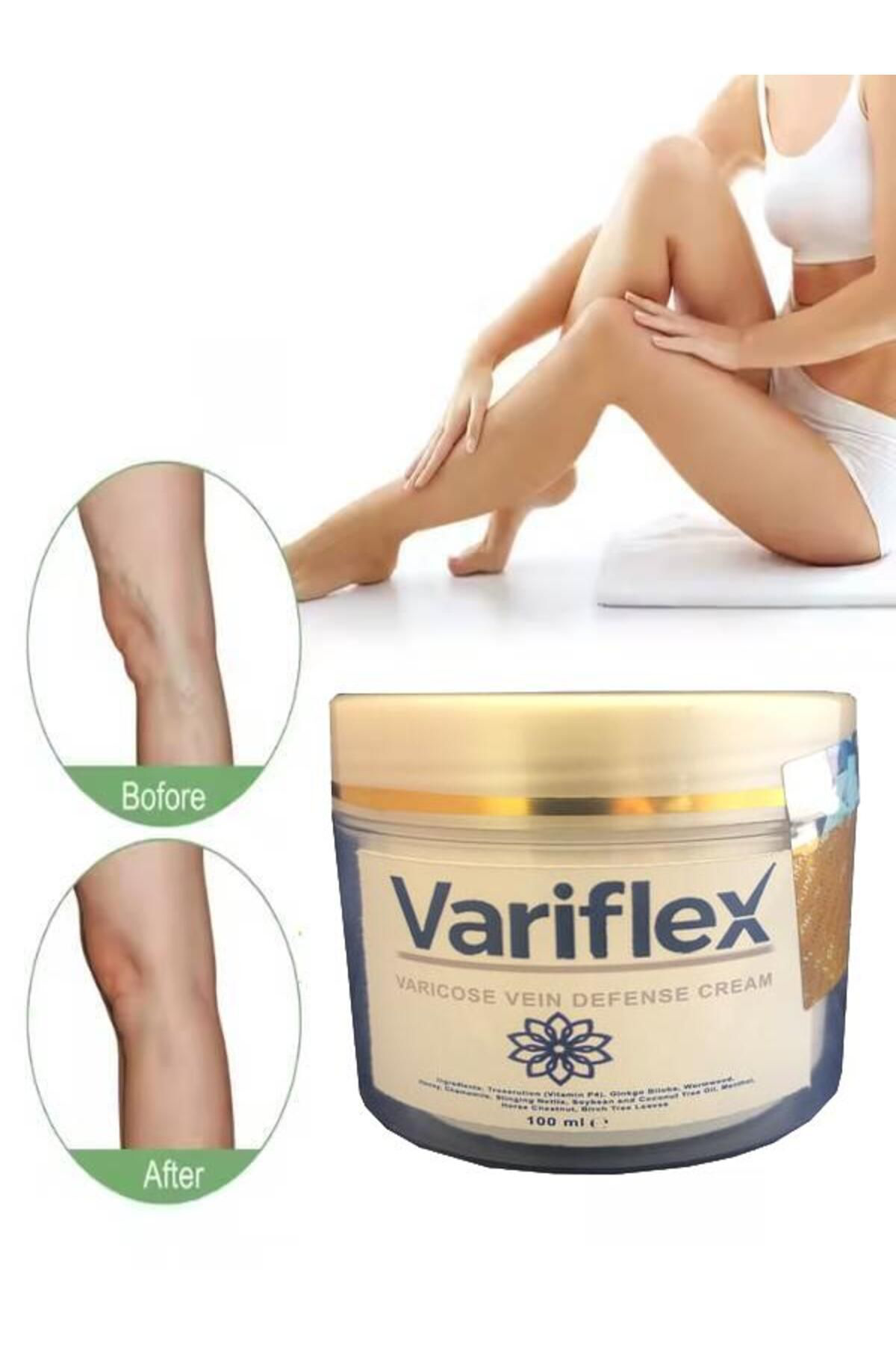 Helsol Variflex Varicose Vein Defense Bacak Var.İsleri İçin Masaj Bakım