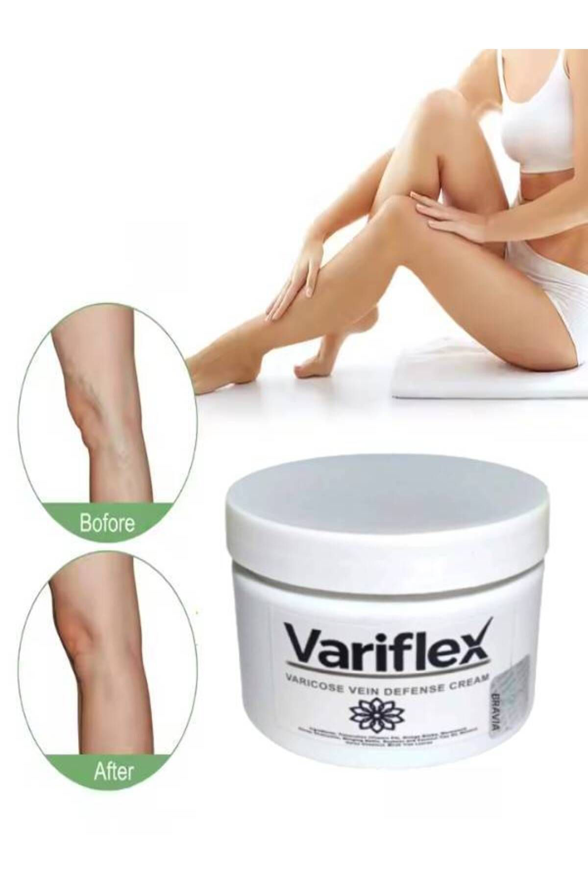 Helsol Variflex Varicose Vein Defense Bacak Var.İsleri İçin Masaj Bakım