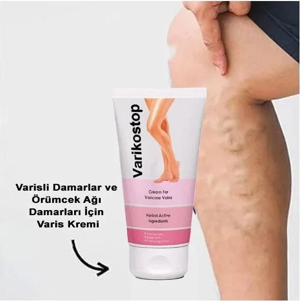 Varikostop Masaj ve Bakım Kremi 50 ml – Varis ve Ağlayan Bacaklar İçin Etkili Bakım Fiyatı, Yorumları ve Özellikleri