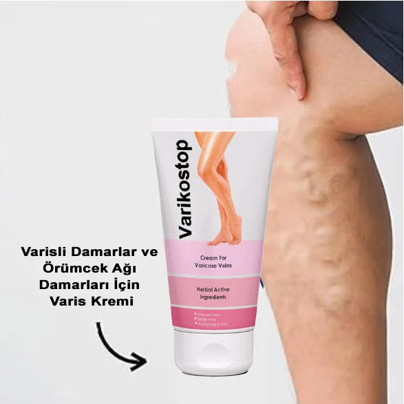 Varikostop Varisli Damarlar İçin Etkili Krem - Bacak Ağrısına İyi Gelen Çözüm