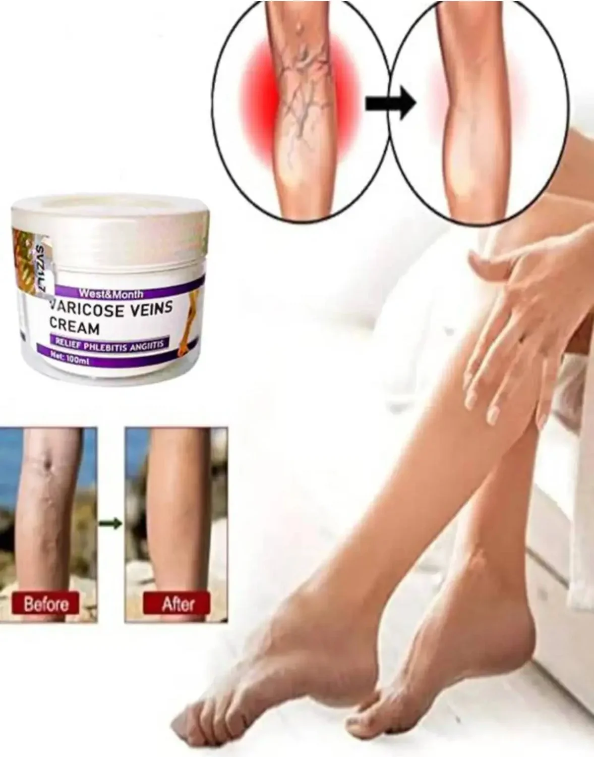 Varis Kremi 100 ml 2 Adet - Bacak Ağrısı ve Toplar İçin Etkili Çözüm