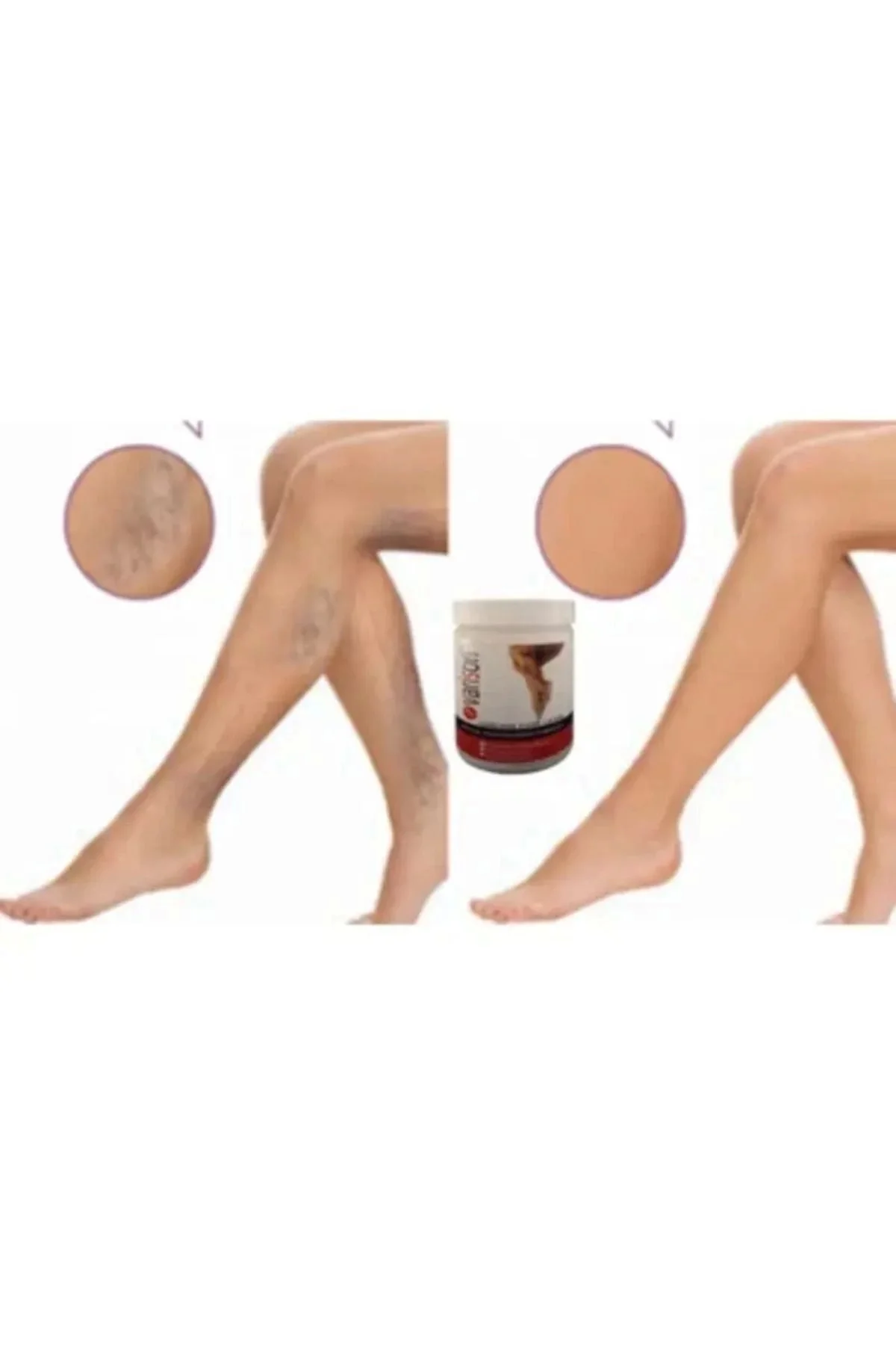 Varis Kremi 200ML (3'lü Paket) - Toplu Varis Damar Kremi
