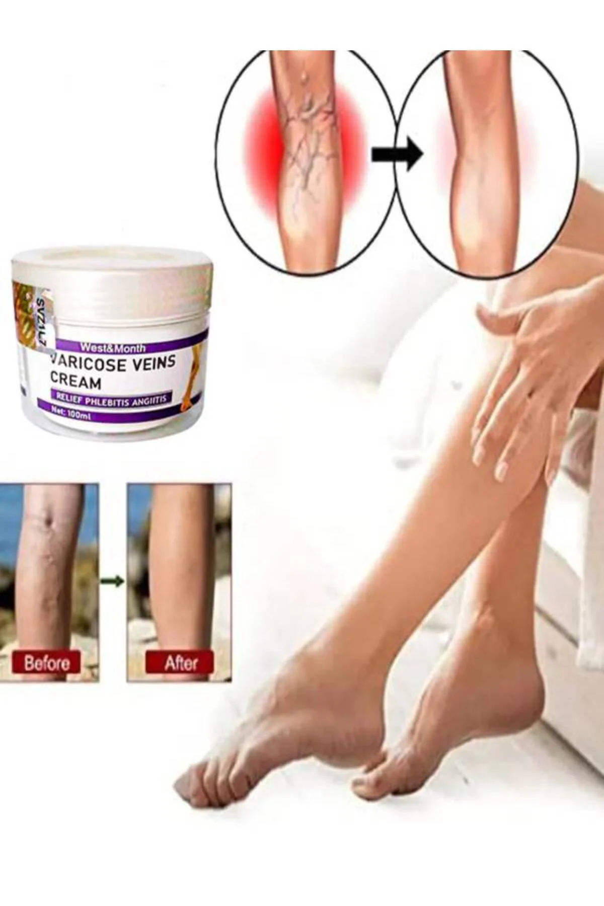 Varis Kremi - Bacak Ağrısı ve Şişlik Karşıtı Bakım Kremi (100 ml 2 Adet)