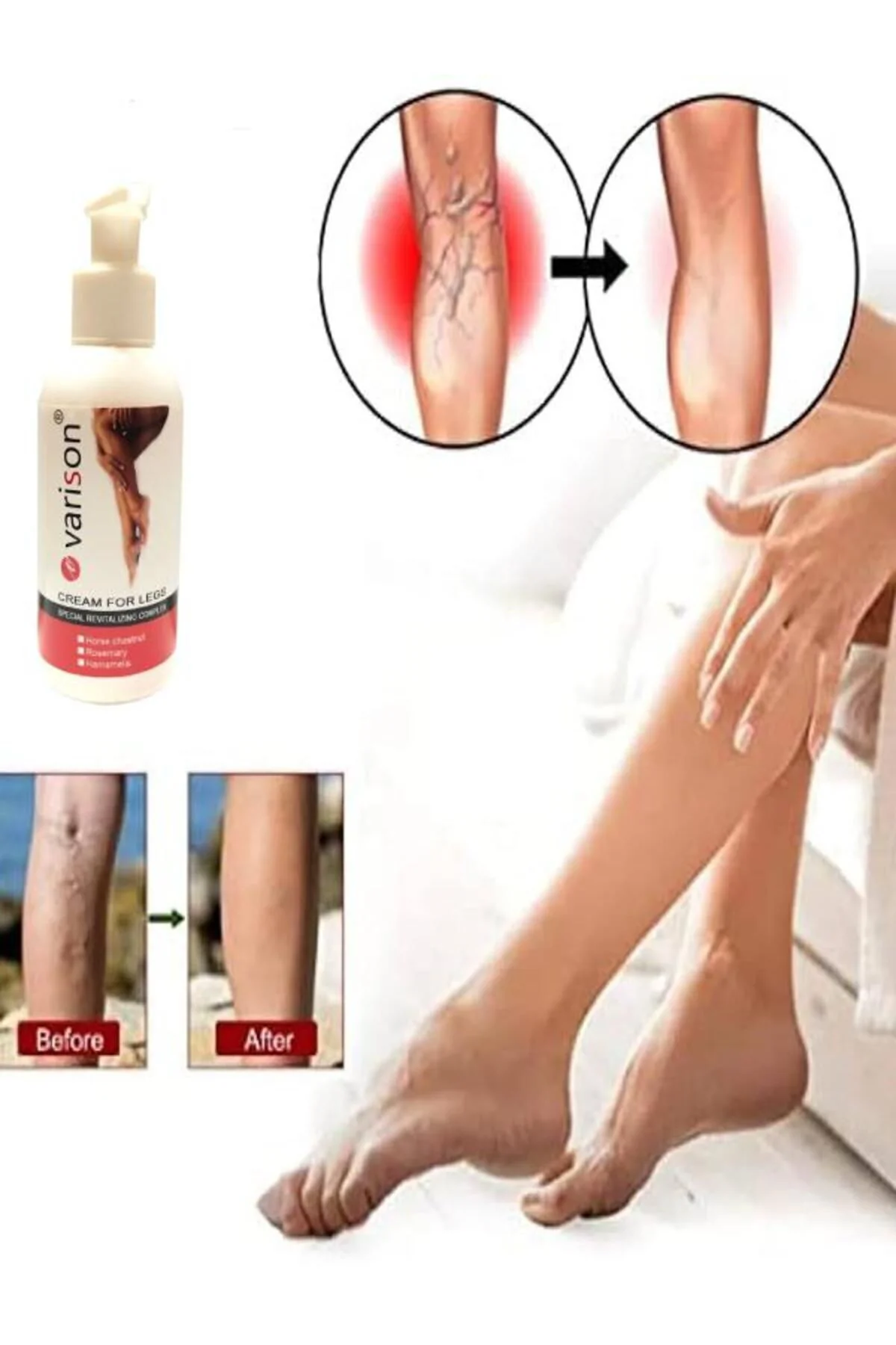 Varis Kremi – Bacak Bakım Kremi 120 Ml | Varis ve Damar Ağrılarına İyi Gelen Ürün