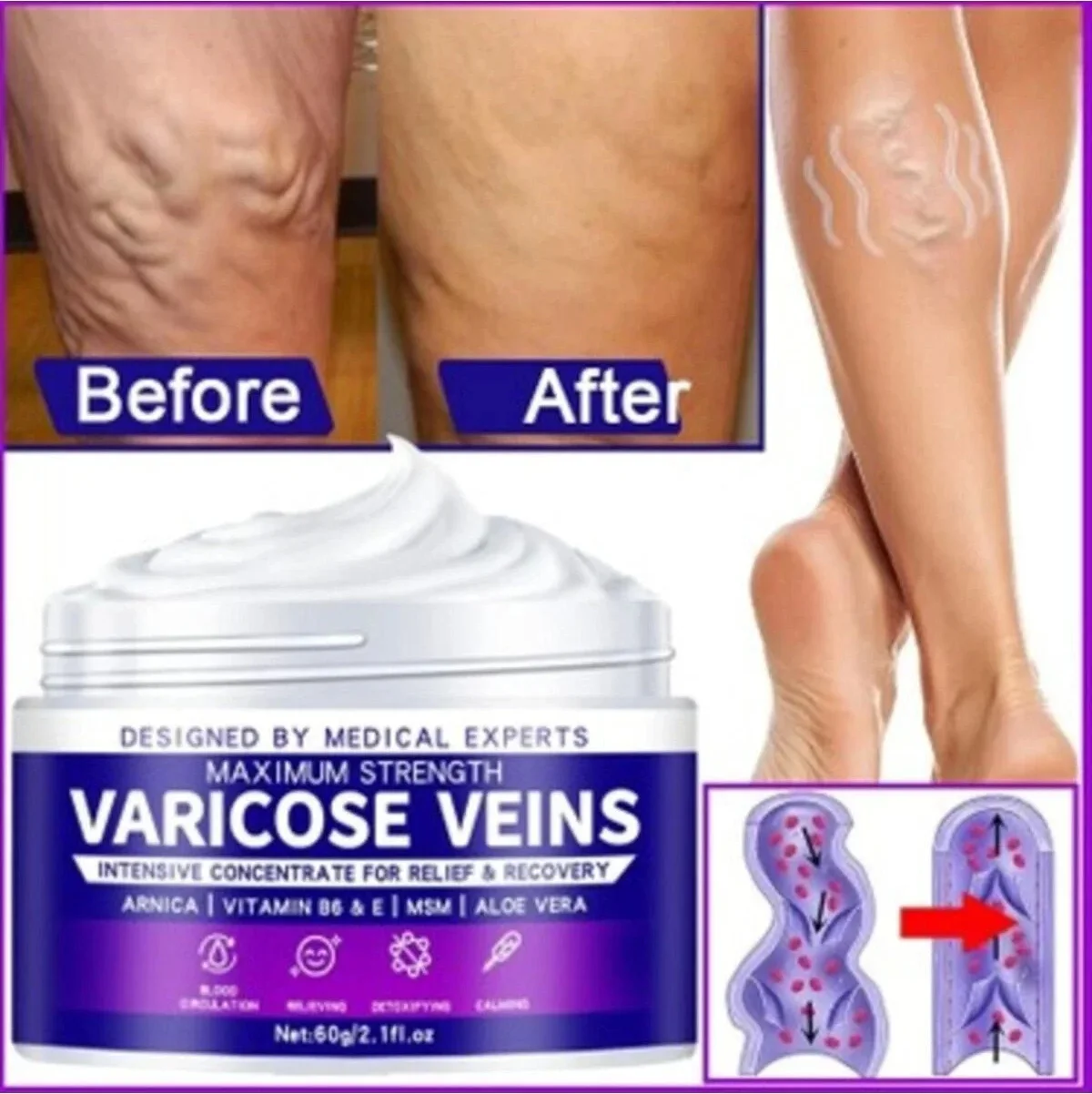 Varis Tedavi Kremi 100 ml x 3 Adet | Bacak Ağrısı ve Varis İçin Etkili Çözüm Fiyatı, Yorumları ve Özellikleri