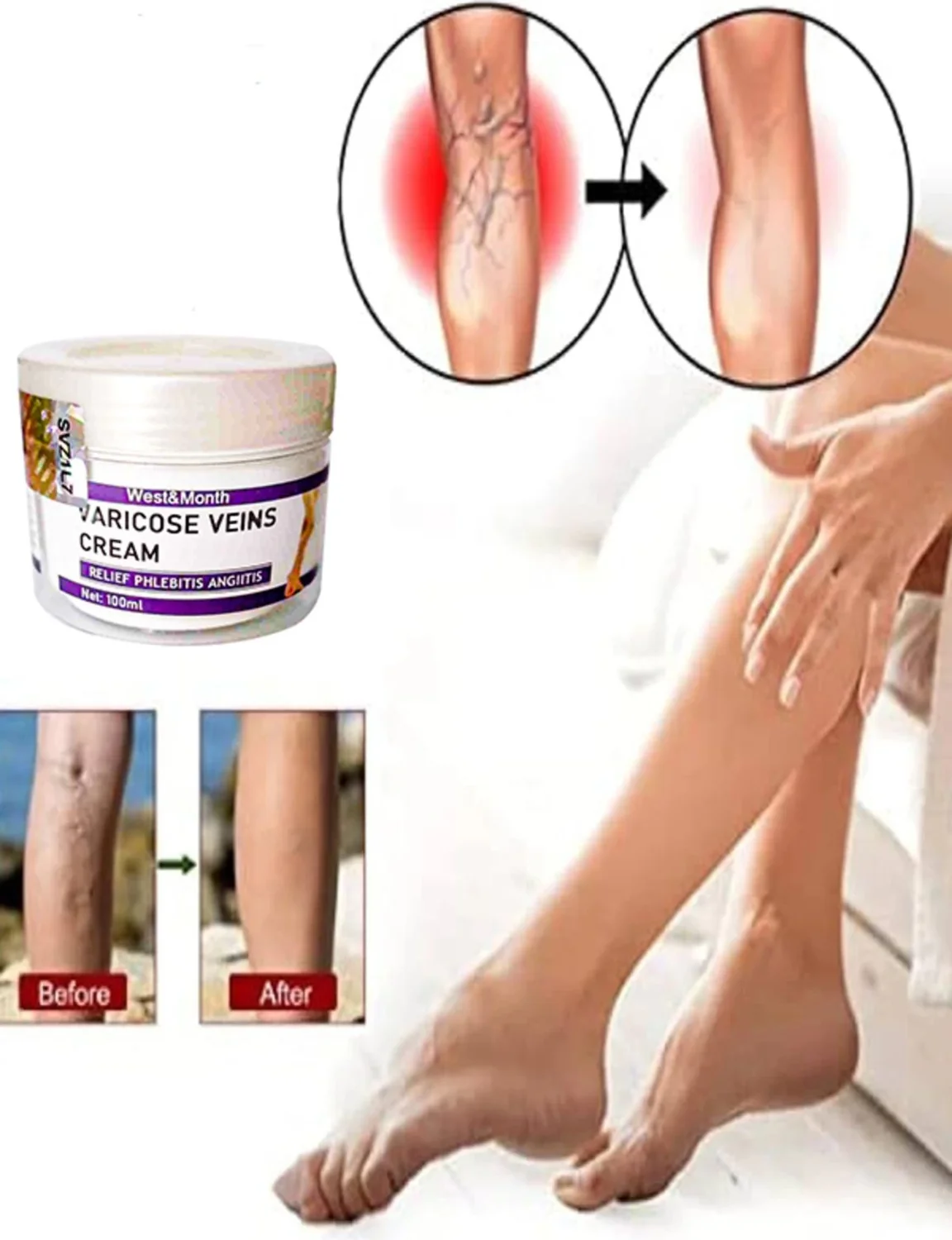 Varis ve Tel Kılcal Damar Kremi - Bacak Ağrısı ve Ağır Bacak İçin Rahatlatıcı Bakım Kremi 100 ml