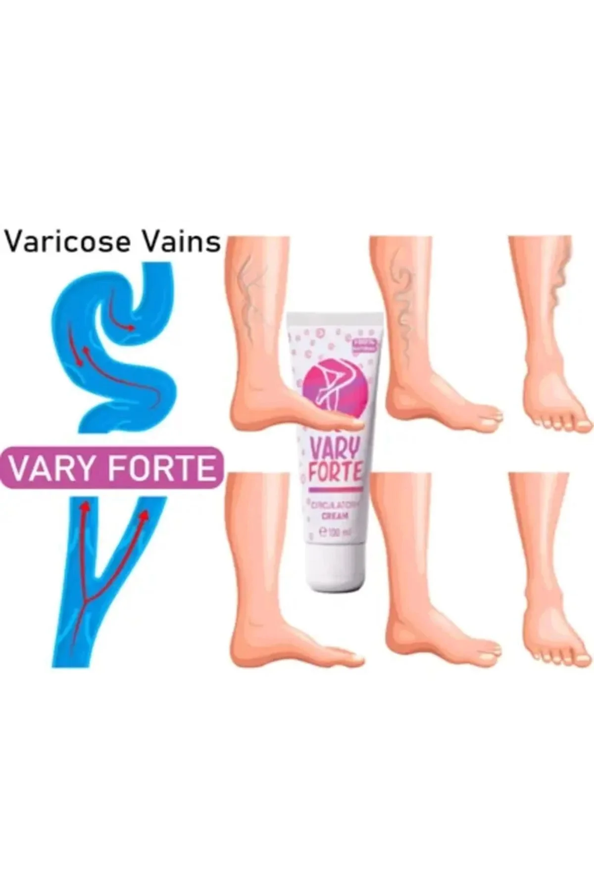 Vary Forte Varis Kremi - Yoğun Varisler İçin Güçlü Etki 100 ml 3 ADET