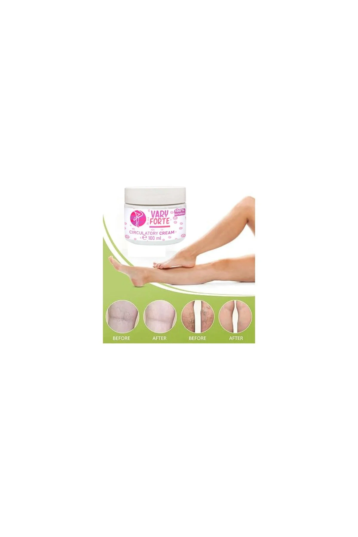 Vary Forte Yoğun Krem – Warislere Karşı Etkili, 100 ml X 2 ADET Kavanoz