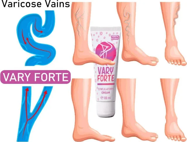 Varyforte Bacak Bakım Kremi - Varis ve Ağır Bacak Hissine Etkili Çözüm 100 ml
