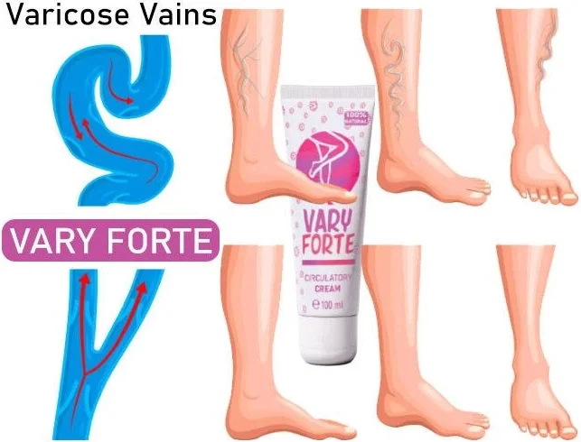 Varyforte ile Uyumlu Varis Kremi - Bacak Ağrısı ve Şişlik Giderici