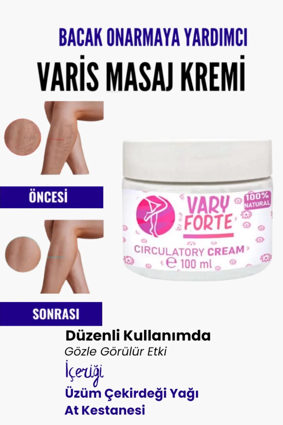 Varyforte Masaj Kremi - Varis Bölgeleri İçin Bacak Onarıcı ve Besleyici Krem 100 ml Fiyatı, Yorumları ve Özellikleri