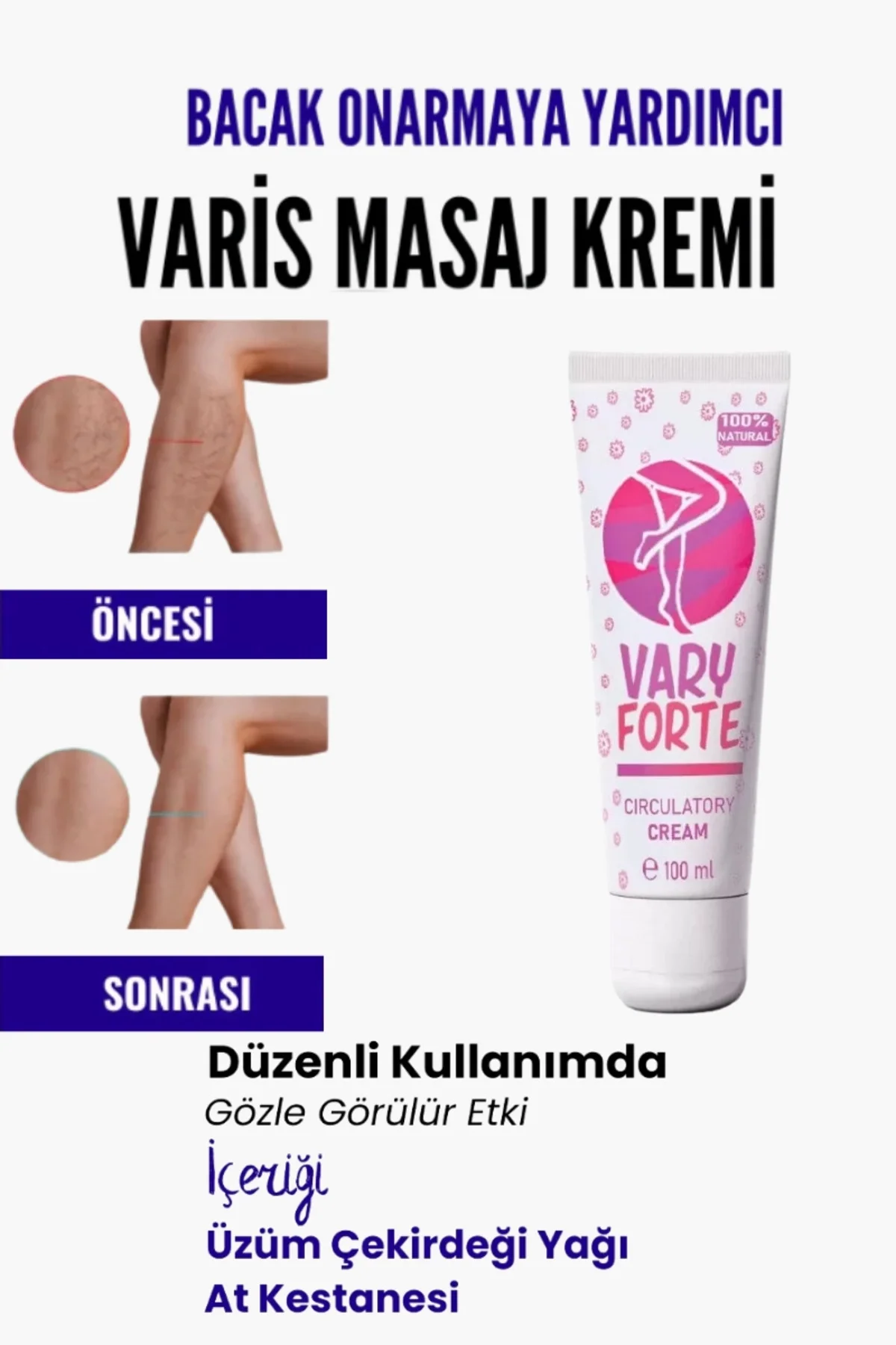 Varyforte Masaj Kremi - Varis İçin Bacak Onarıcı Bakım Kremi 100ml Fiyatı, Yorumları ve Özellikleri