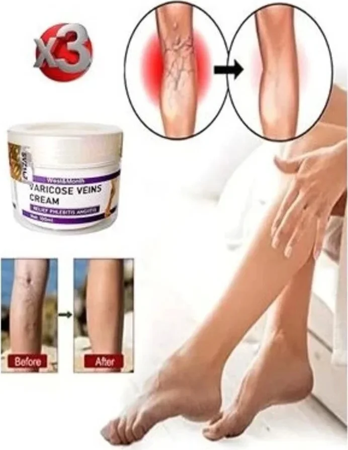 V.ricose & Spider Vns Sthing Bacak Bakım Kremi - Varis ve Tel Kılcal Damarlara Karşı 100 ml x 3 Adet