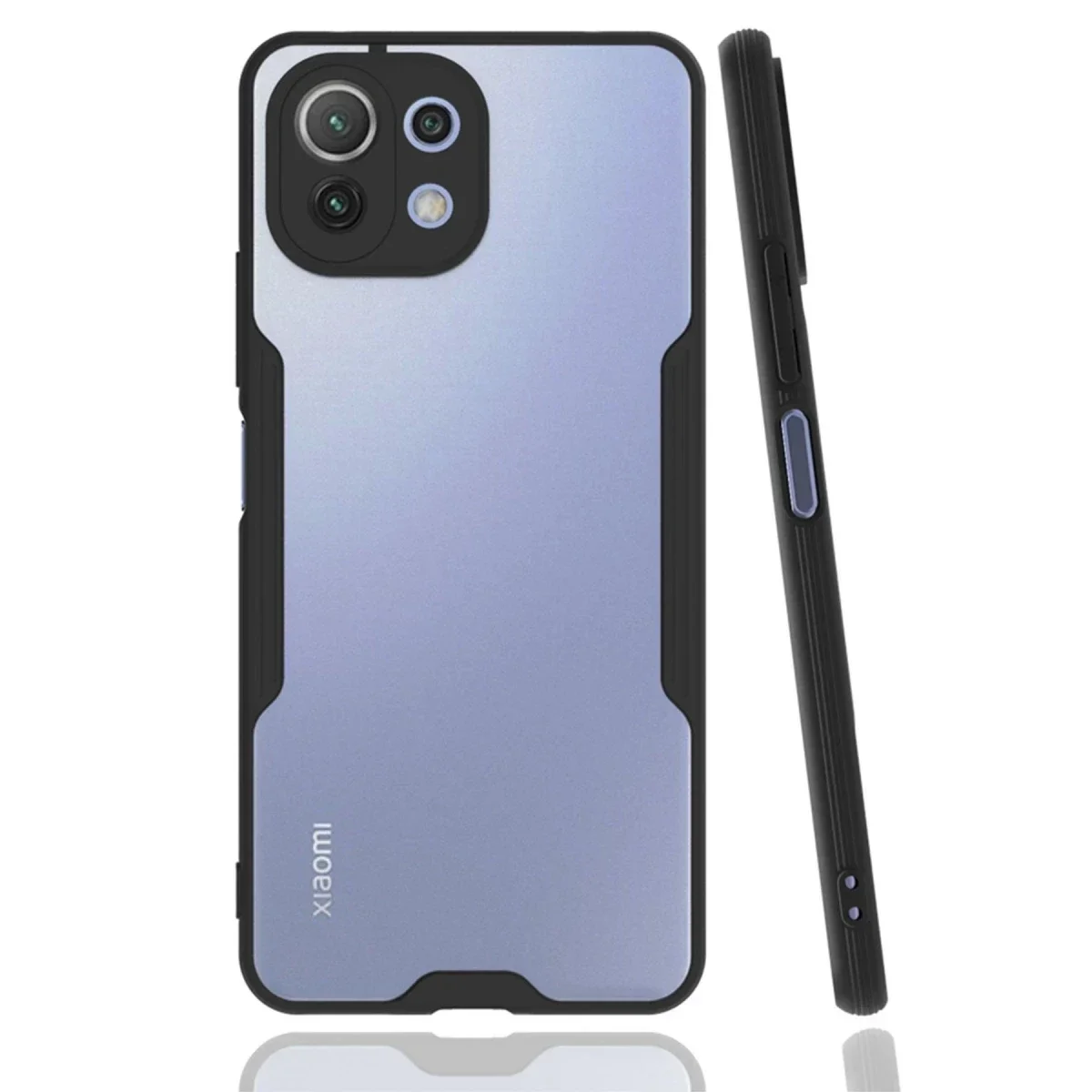 Xiaomi Mİ 11 Lite Kılıf Platin Silikon - Siyah
