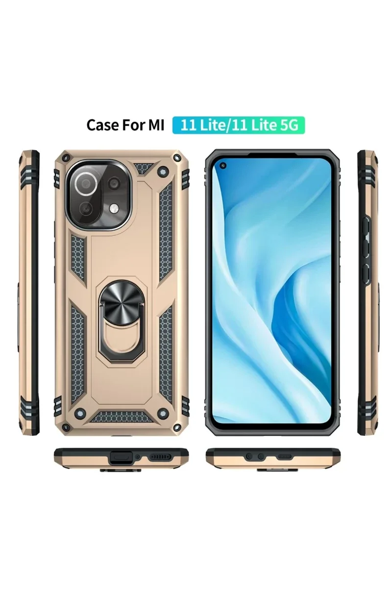 Xiaomi Mİ 11 Lite Kılıf Sofya Yüzüklü Silikon Kapak - Gold Fiyatı, Yorumları ve Özellikleri