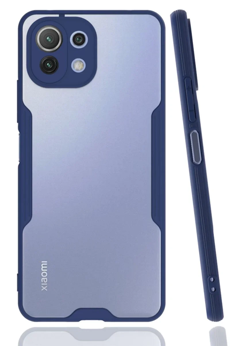 Xiaomi Mİ 11 Lite Kılıf Platin Silikon - Lacivert Xiaomi Mİ 11 Lite Kılıf Platin Silikon - Lacivert