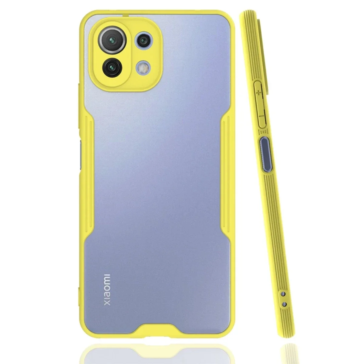 Xiaomi Mİ 11 Lite Kılıf Platin Silikon - Sarı Xiaomi Mİ 11 Lite Kılıf Platin Silikon - Sarı