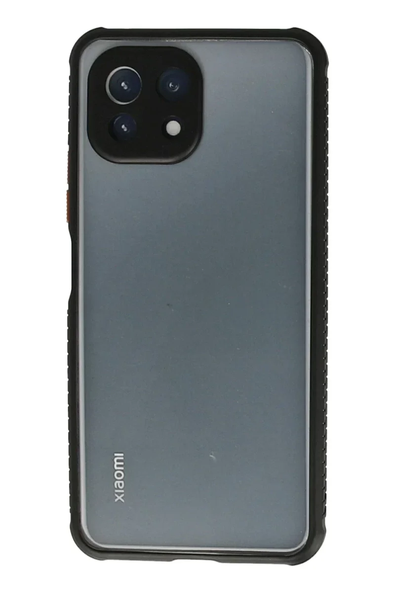 Xiaomi Mİ 11 Lite Kılıf Miami Şeffaf Silikon - Siyah Fiyatı, Yorumları ve Özellikleri