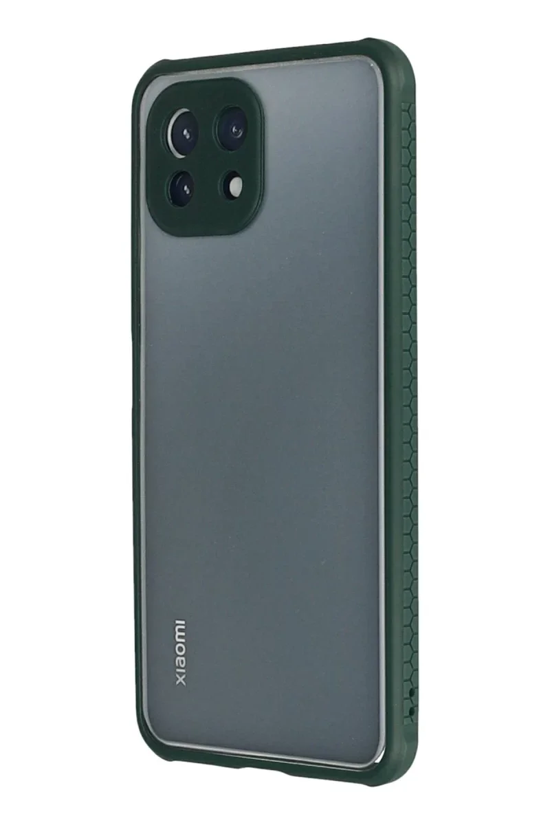 Xiaomi Mİ 11 Lite Kılıf Miami Şeffaf Silikon - Koyu Yeşil Fiyatı, Yorumları ve Özellikleri