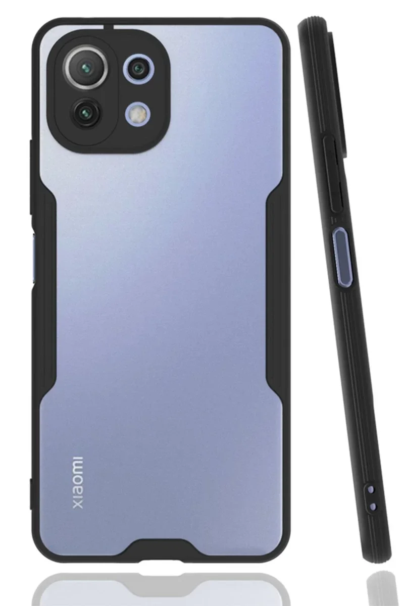 Xiaomi Mİ 11 Lite Kılıf Platin Silikon - Siyah