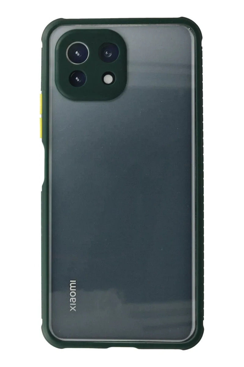 Xiaomi Mİ 11 Lite Kılıf Miami Şeffaf Silikon - Koyu Yeşil Fiyatı, Yorumları ve Özellikleri