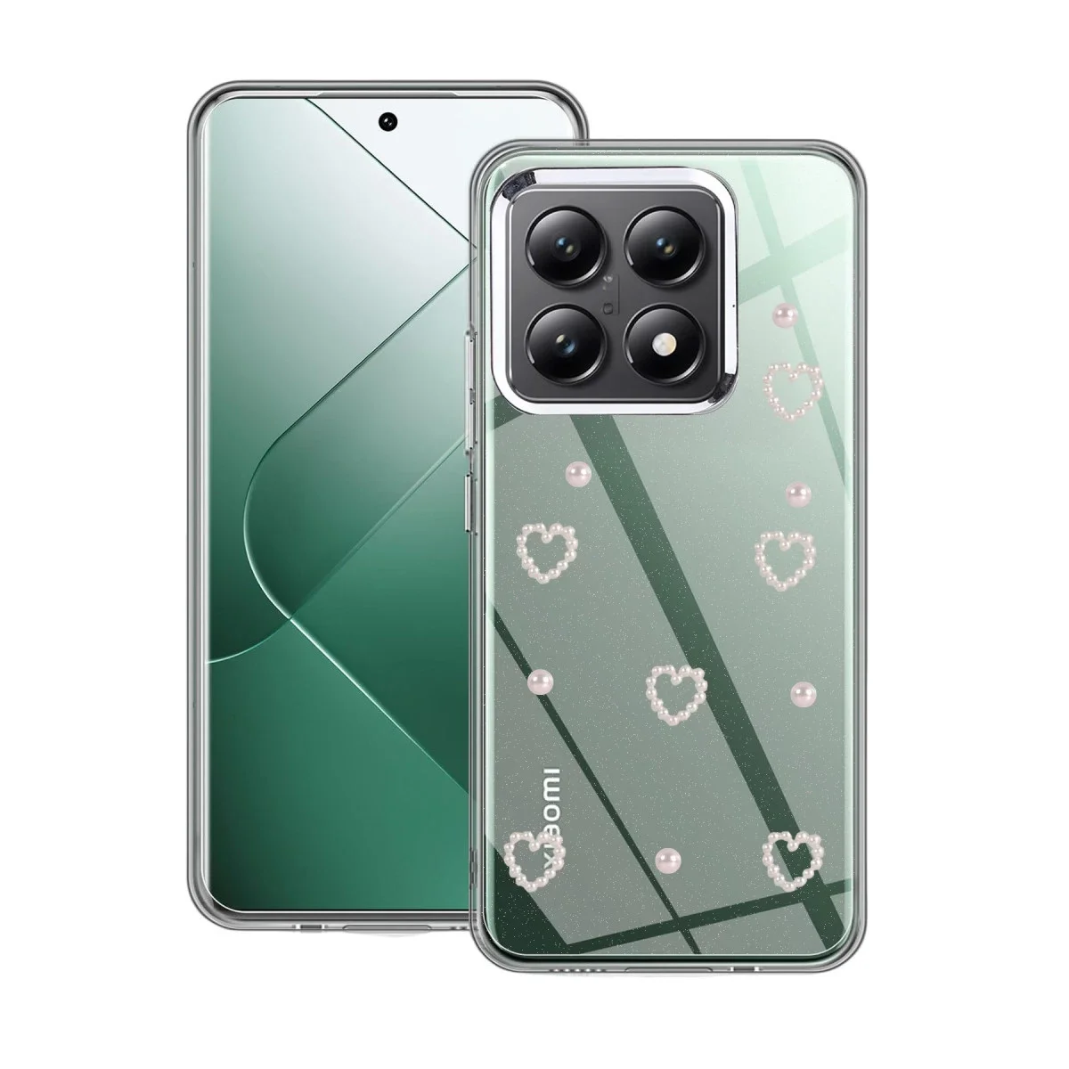 Xiaomi Mi 14T Pro Fiyonk Desenli Kapak - Desen 10 Fiyatı, Yorumları ve Özellikleri