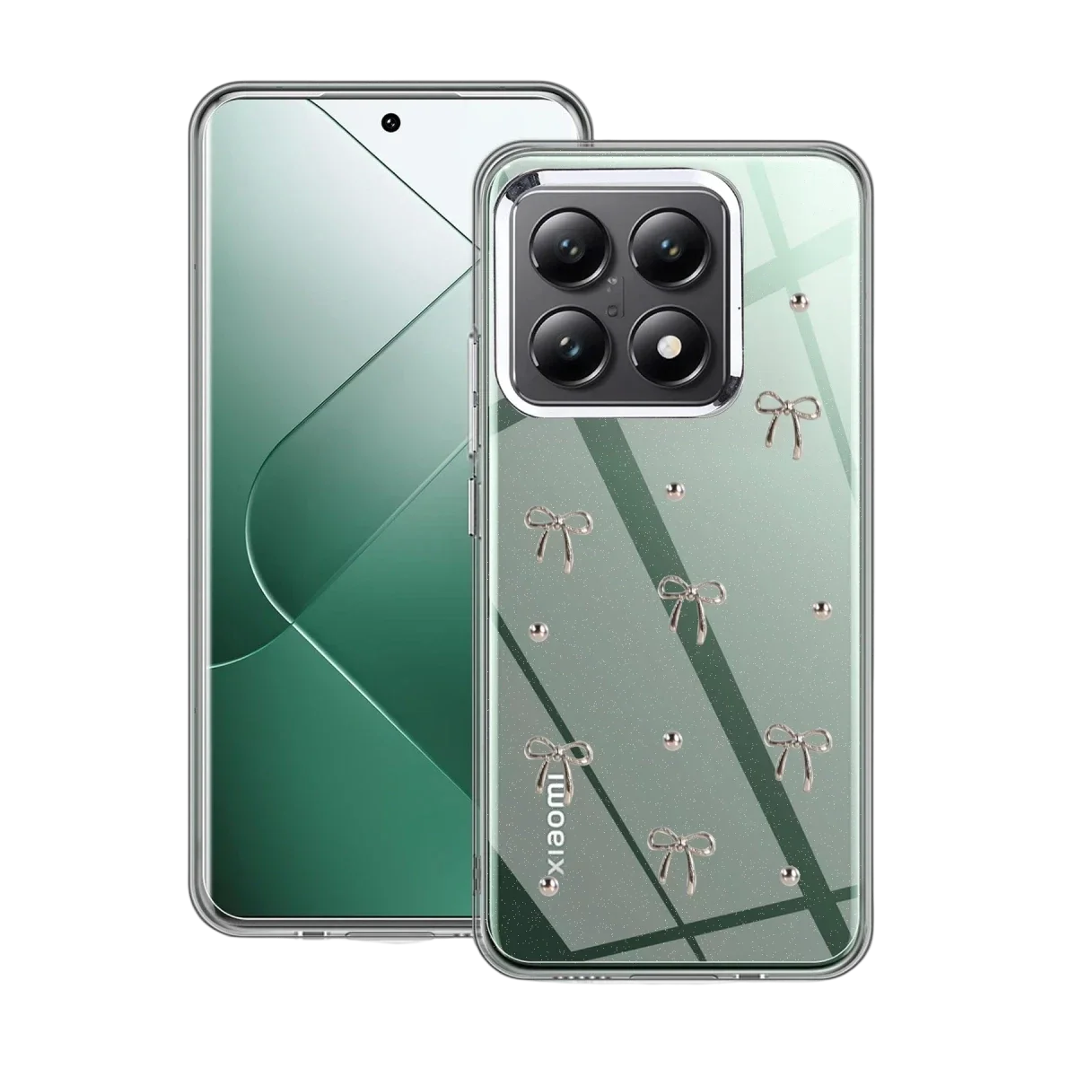 Xiaomi Mi 14T Pro Fiyonk Desenli Kapak - Desen 5 Fiyatı, Yorumları ve Özellikleri