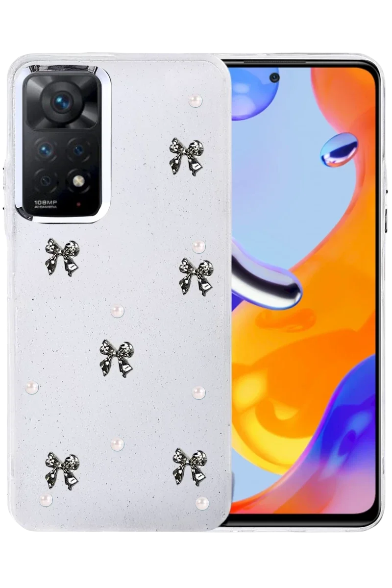 Xiaomi Redmi Note 11 Pro Fiyonk Desenli Kapak - Desen 8 Fiyatı, Yorumları ve Özellikleri