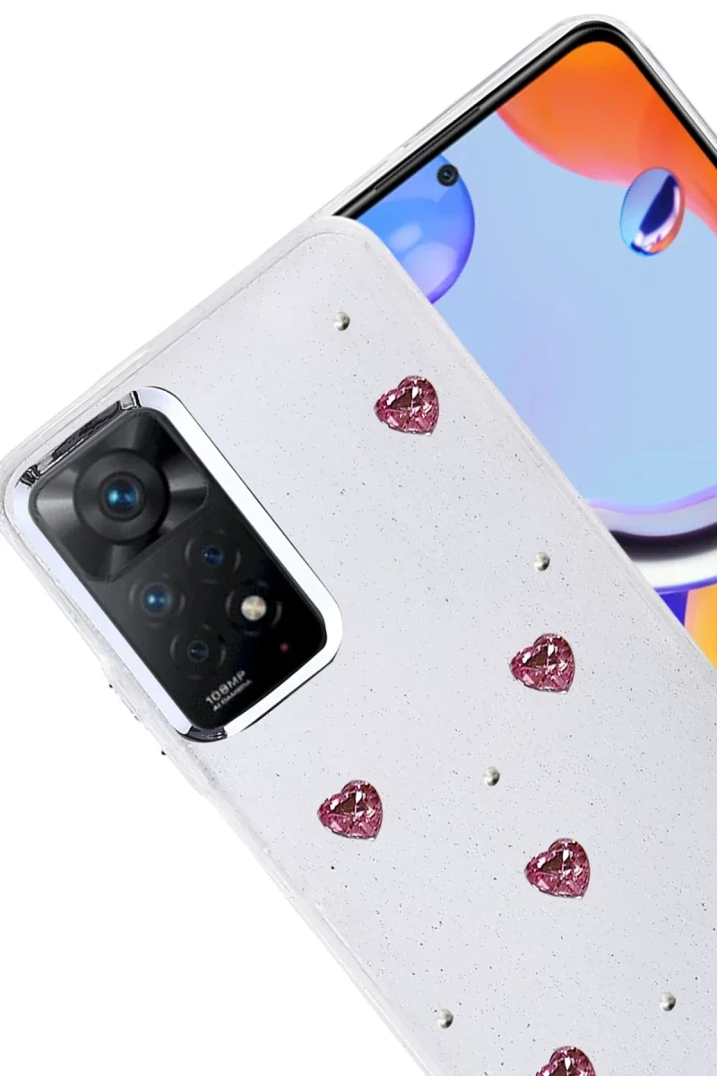 Xiaomi Redmi Note 11 Pro Fiyonk Desenli Kapak - Desen 3 Fiyatı, Yorumları ve Özellikleri