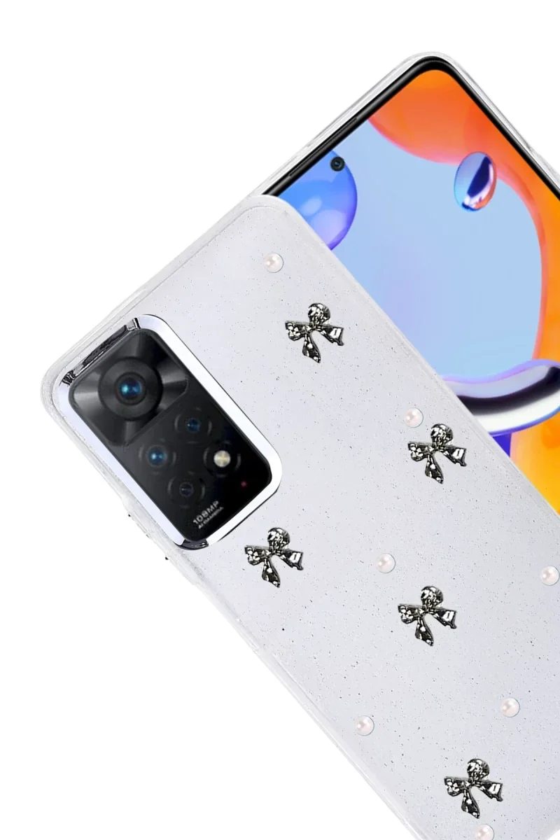 Xiaomi Redmi Note 11 Pro Fiyonk Desenli Kapak - Desen 8 Fiyatı, Yorumları ve Özellikleri