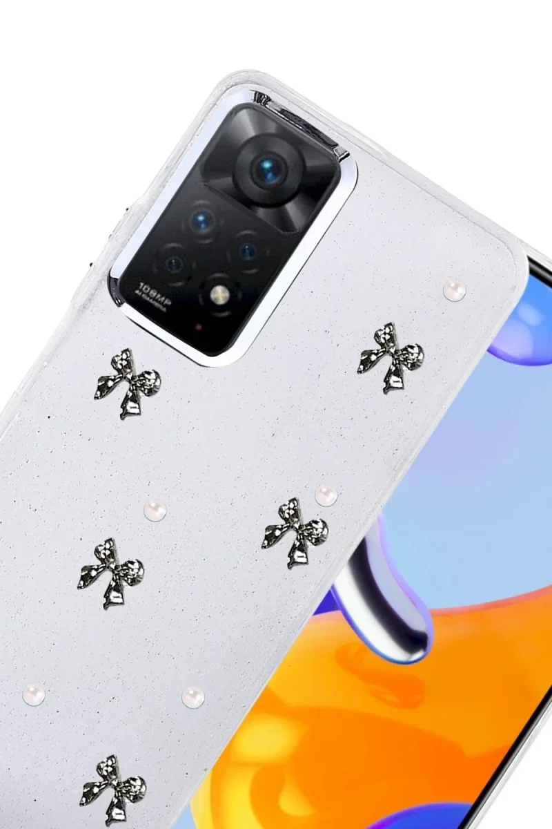 Xiaomi Redmi Note 11 Pro Fiyonk Desenli Kapak - Desen 8 Fiyatı, Yorumları ve Özellikleri