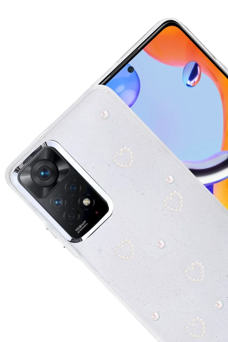 Xiaomi Redmi Note 11 Pro Fiyonk Desenli Kapak - Desen 10 Fiyatı, Yorumları ve Özellikleri
