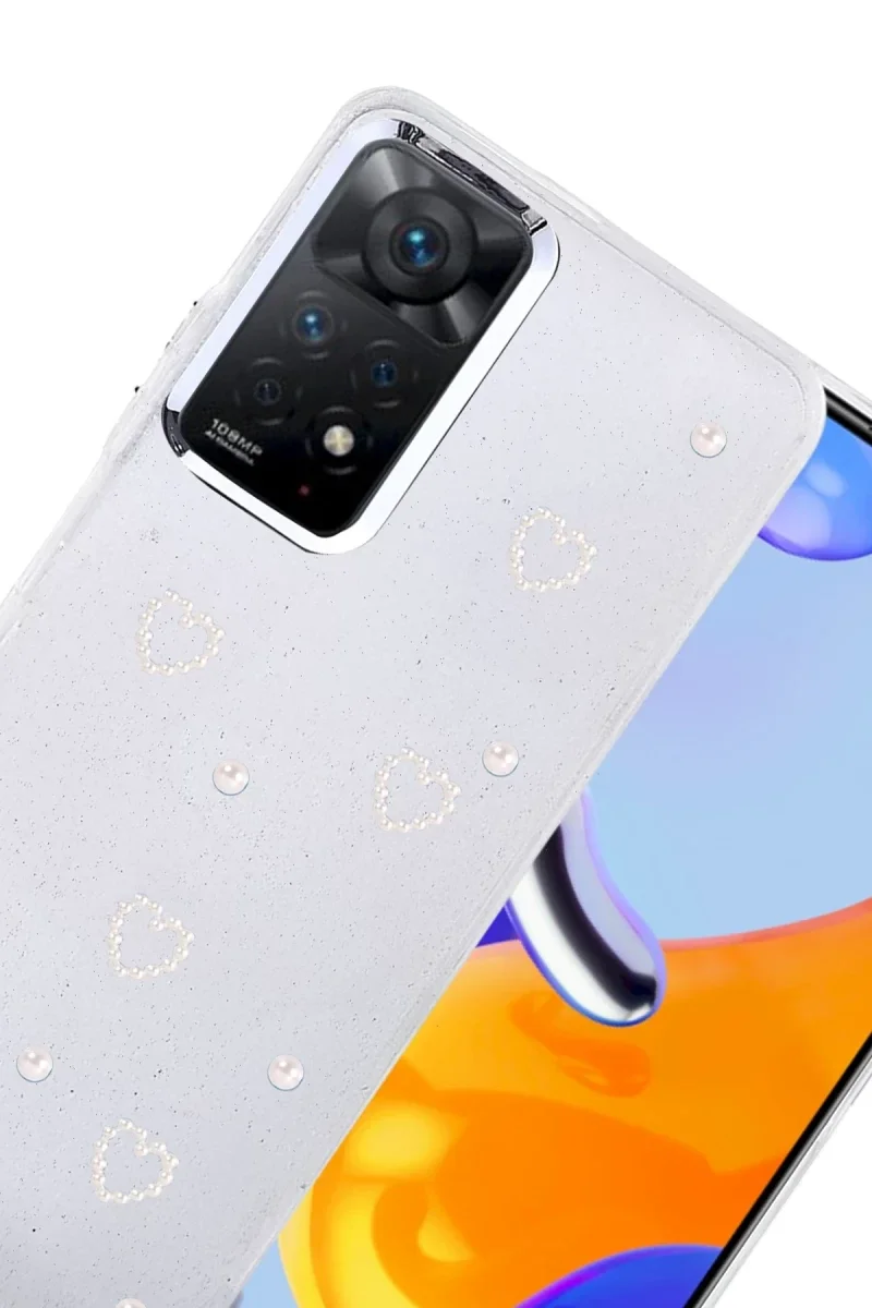 Xiaomi Redmi Note 11 Pro Fiyonk Desenli Kapak - Desen 10 Fiyatı, Yorumları ve Özellikleri