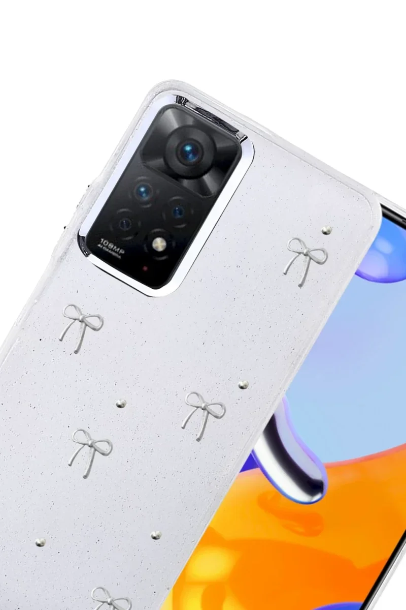 Xiaomi Redmi Note 11 Pro Fiyonk Desenli Kapak - Desen 5 Fiyatı, Yorumları ve Özellikleri