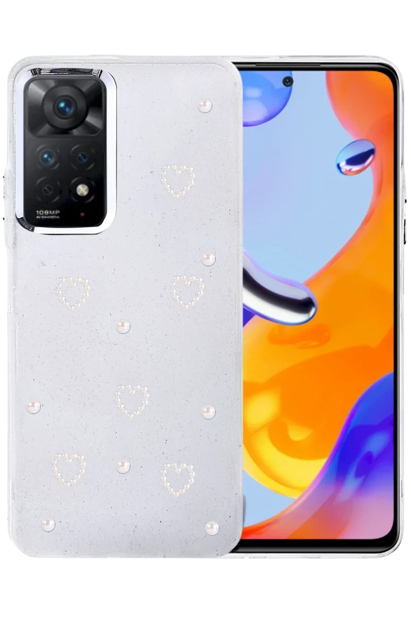 Xiaomi Redmi Note 11 Pro Fiyonk Desenli Kapak - Desen 10 Fiyatı, Yorumları ve Özellikleri