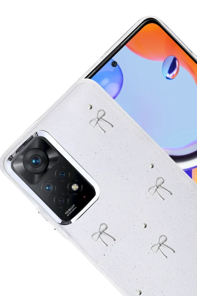 Xiaomi Redmi Note 11 Pro Fiyonk Desenli Kapak - Desen 5 Fiyatı, Yorumları ve Özellikleri
