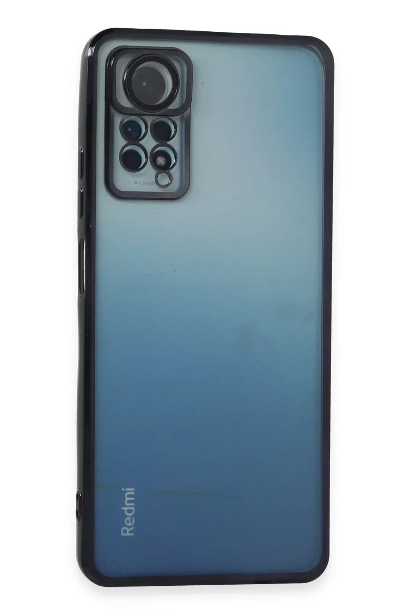 Xiaomi Redmi Note 11 Pro Kılıf Razer Lensli Silikon - Siyah