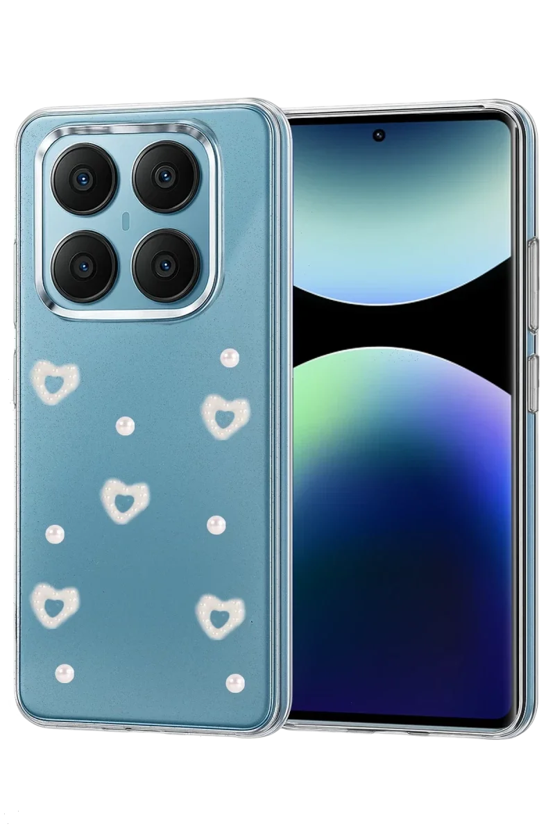 Xiaomi Redmi Note 14 Pro 4G Fiyonk Desenli Kapak - Desen 10 Fiyatı, Yorumları ve Özellikleri