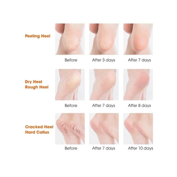 Yoğun Nemlendirme Sağlayan Silikon Topuk Çorabı