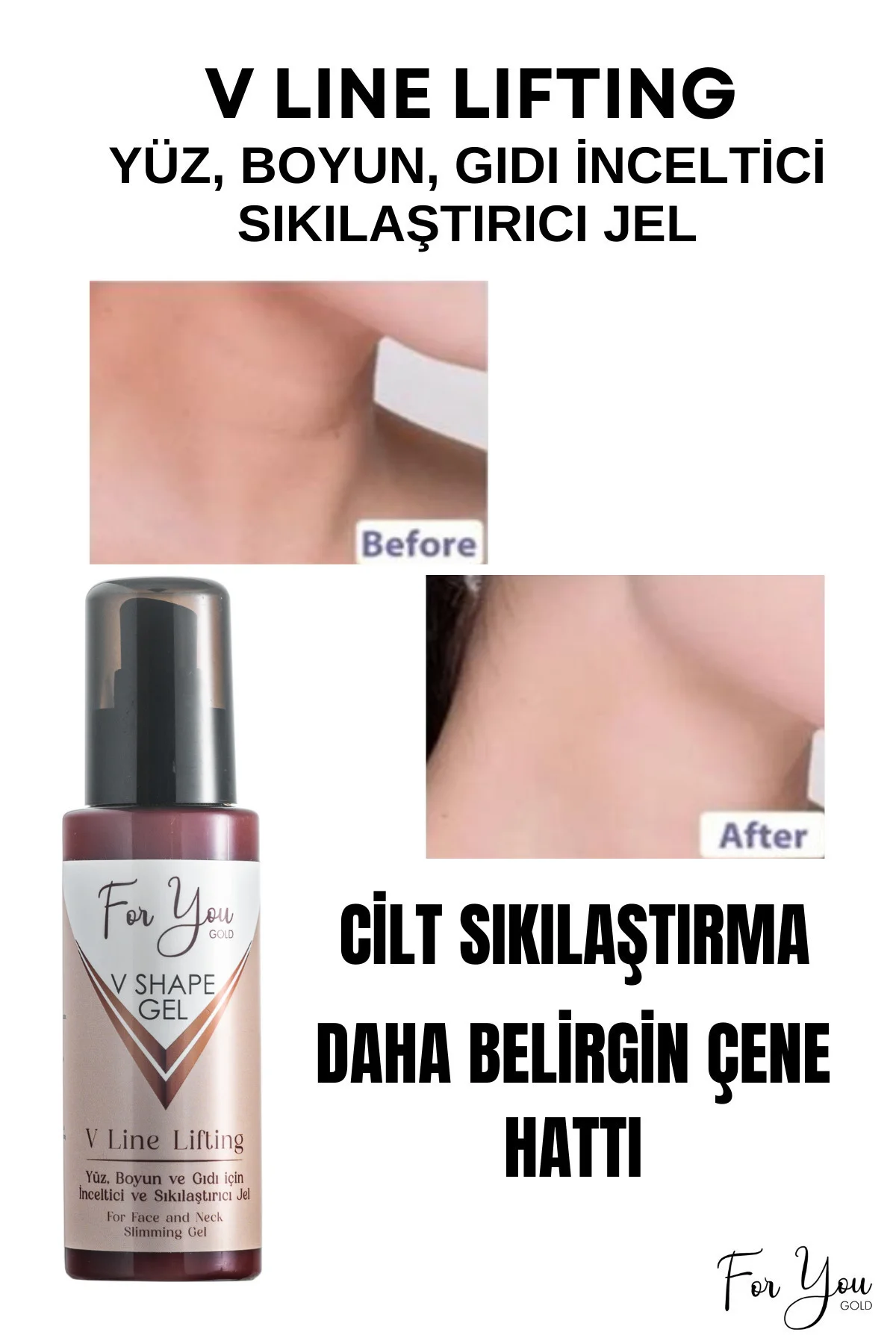 Yüz, Boyun, Çene Ve Gıdı Için Incelmeye Yardımcı, Sıkılaştırıcı V