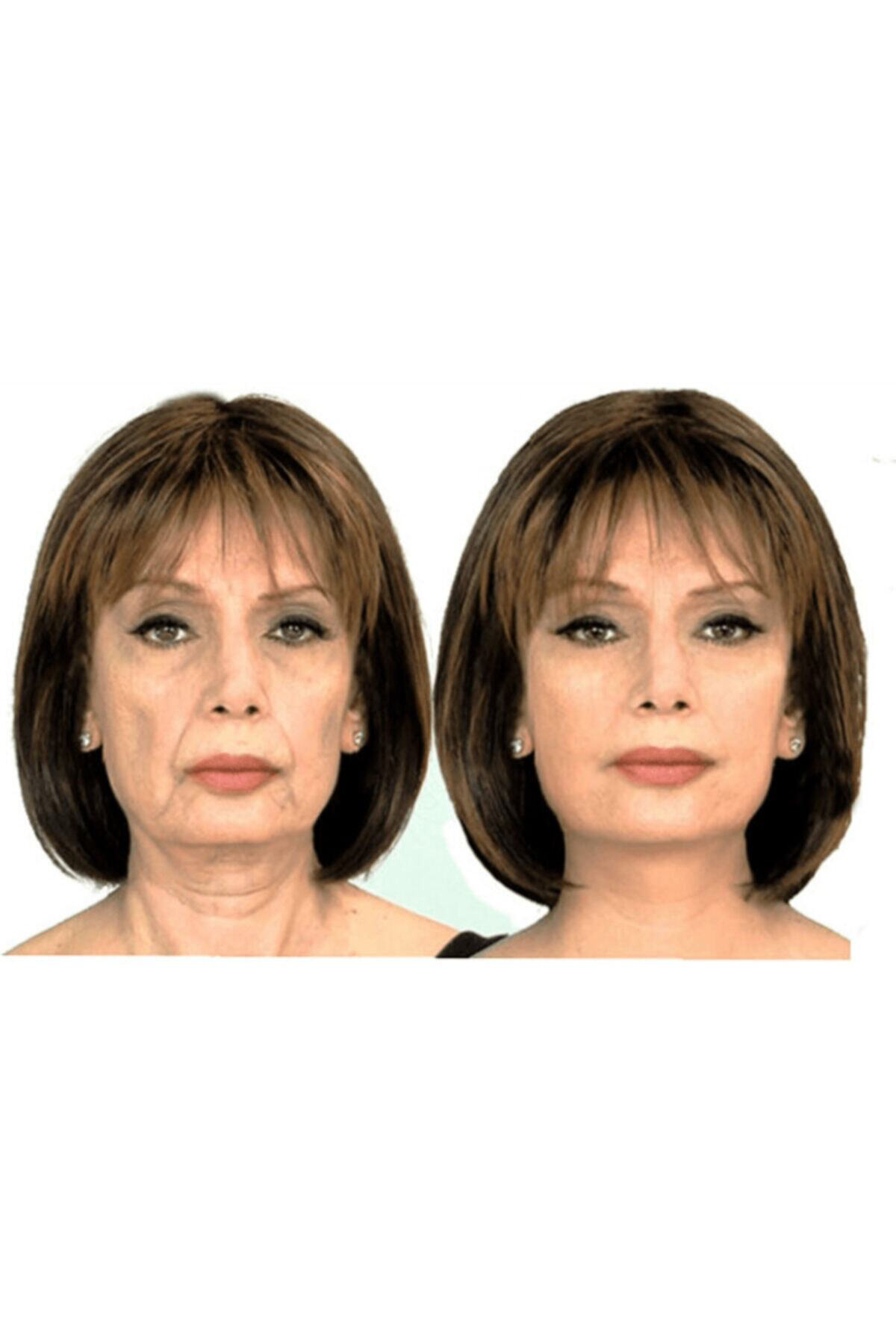 Yüz Gerdirme Bandı Kırışıklık Oluşumunu Engelleme Bandı Yüz Germe